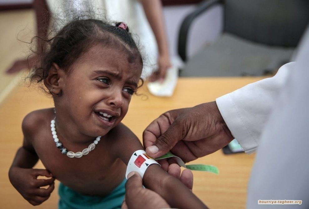 انتشـار الكوليرا يتسارع في اليمن
