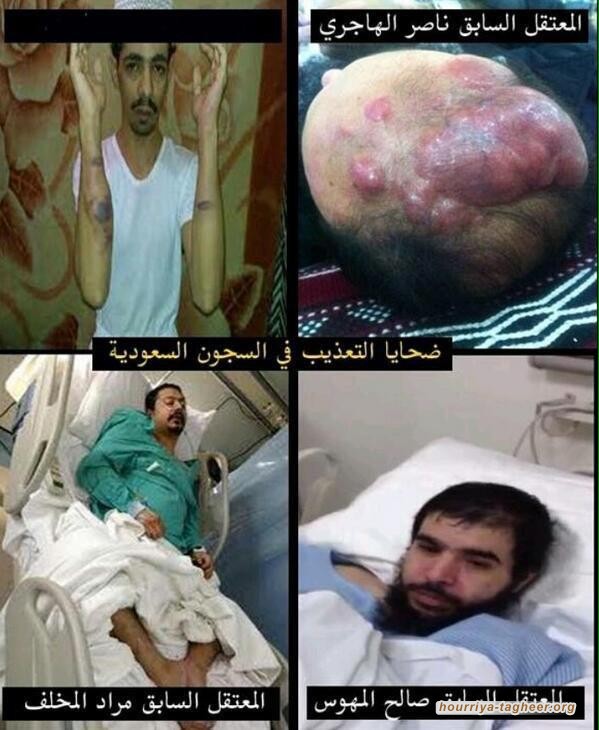 مملكة التعذيب.. آل سعود يواصلون انتهاكات حقوق الإنسان رغم الصرخات الدولية