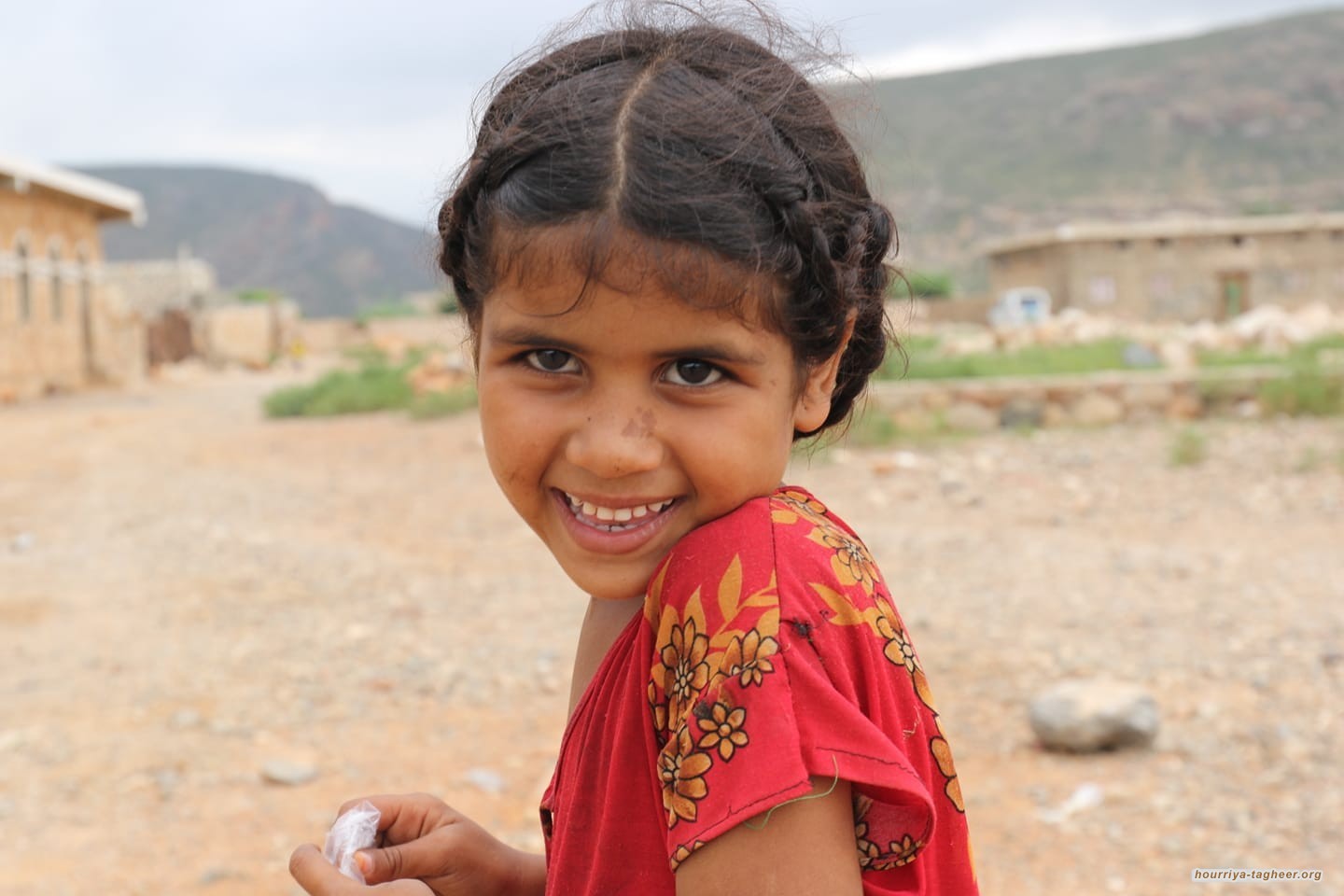 أطفال اليمن مهددون بالموت في مستشفيات الحديدة