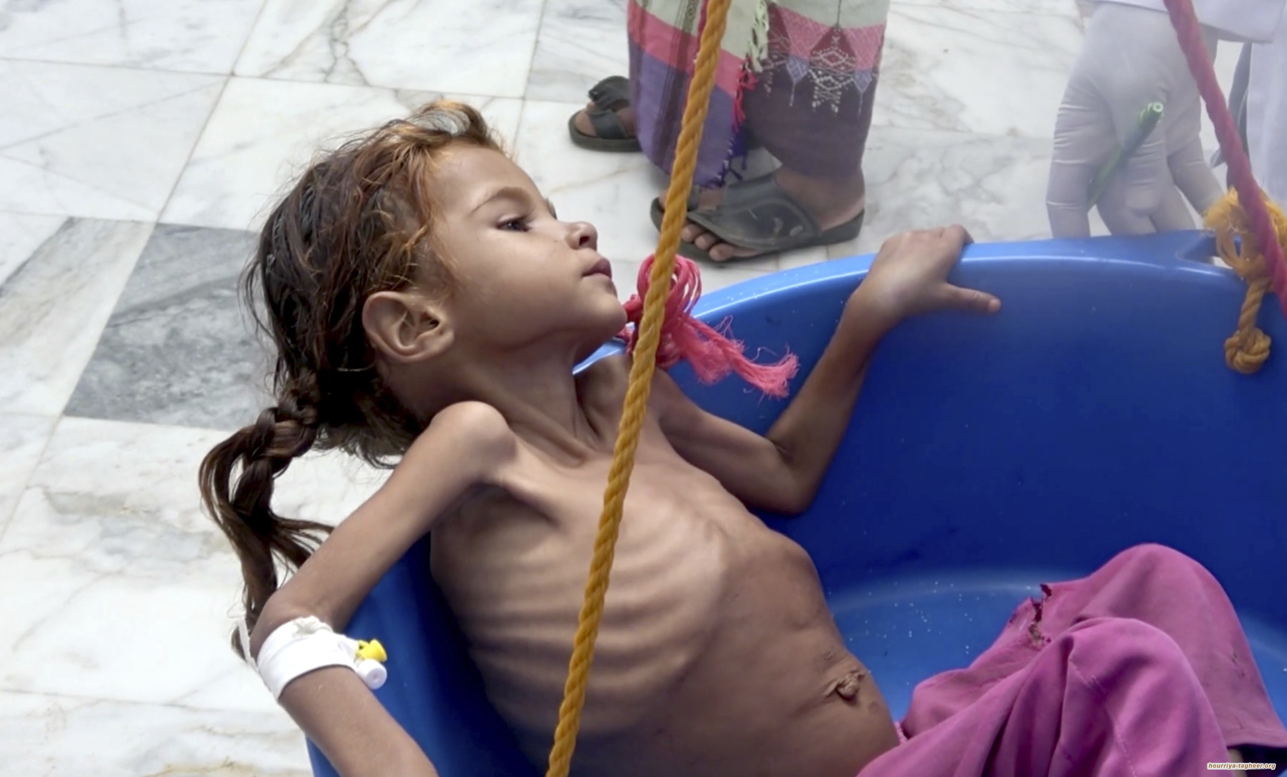 السعودية عرضت اليمن لأسوأ أزمة إنسانية في العالم