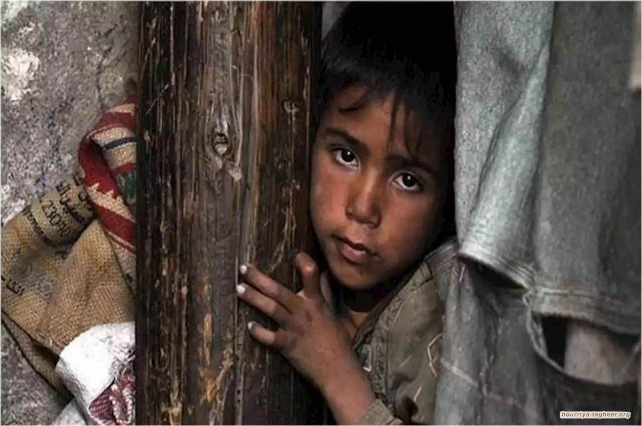 يونيسف: 4ر2 مليون من أطفال اليمن يواجهون سوء التغذية والصحة