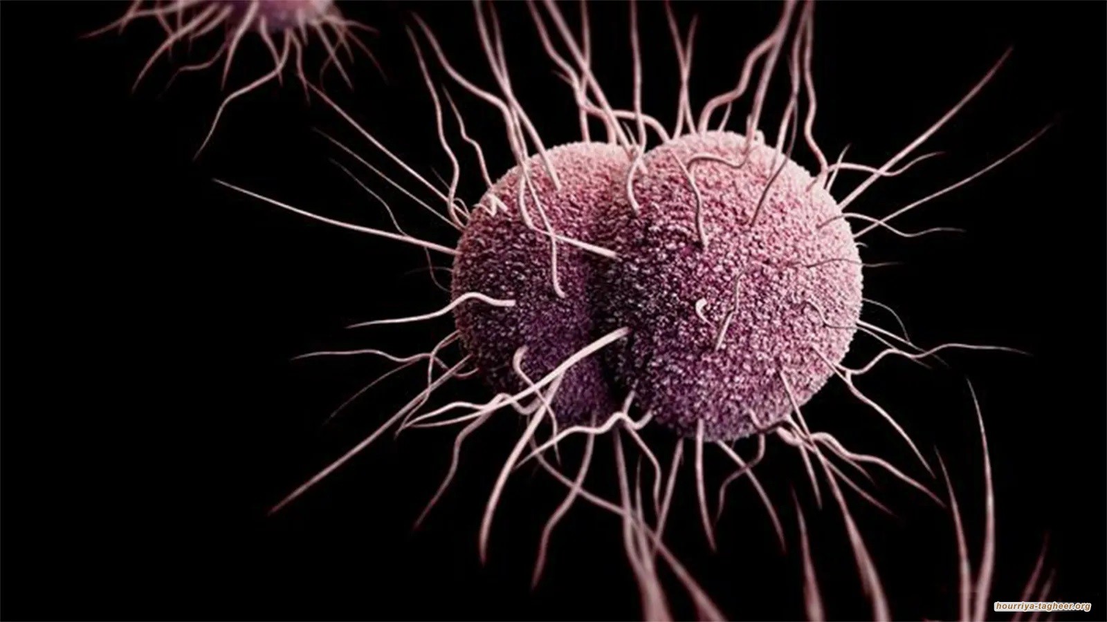 بكتيريا قاتلة تتصرف بشكل مختلف في السعودية