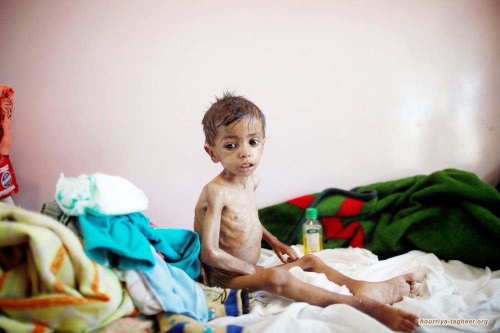 كورونا.. الوباء الذي أفزع الصين وأيقظ العالم على كارثة اليمن