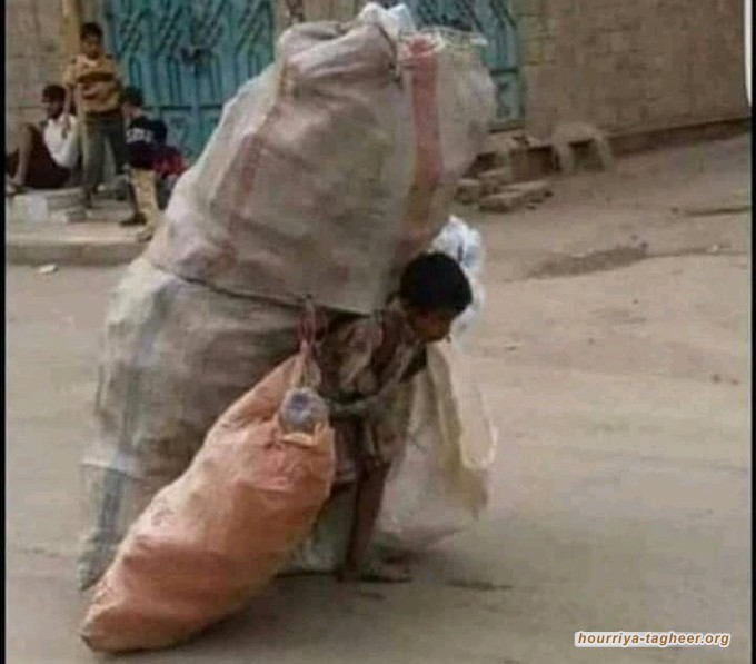 اطفال اليمن يصارعون الحياة من أجل البقاء