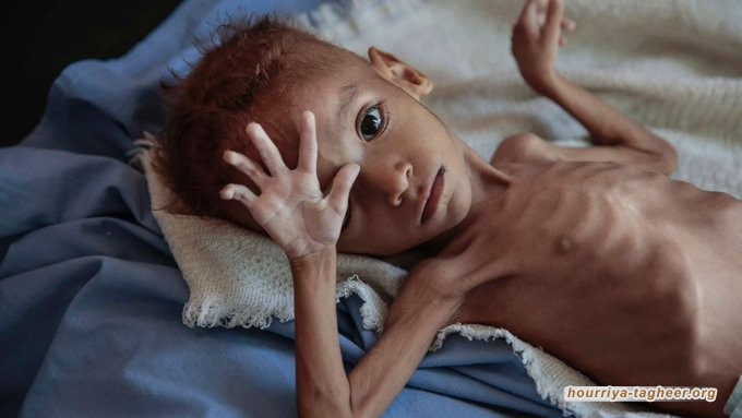 فيلم تركي قصير ومؤثر للغاية يجسد حال مجاعة ولوعة أطفال اليمن