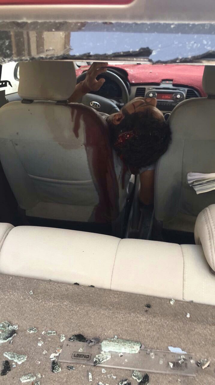 بالصور، الاغارة على العوامية يوم امس وقتل اهلها