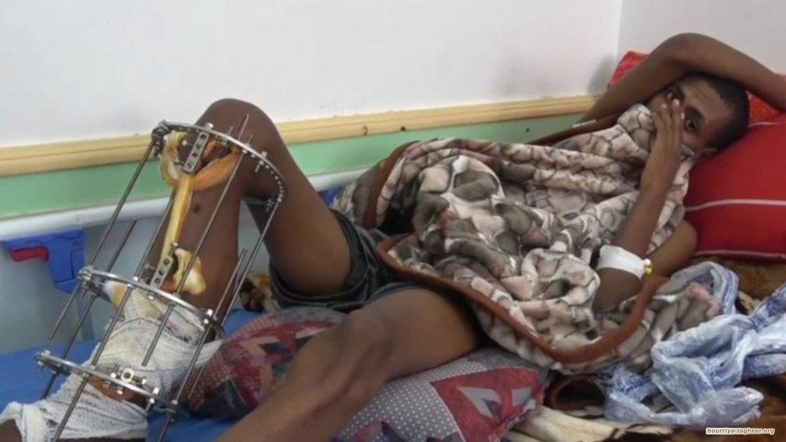 قتل واغتصاب وتعذيب وحشي.. جرائم مروّعة لحرس الحدود السعودي بحق الإثيوبيين