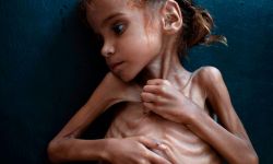 التحالف السعودي يسرق المساعدات من أفواه الجائعين في اليمن؟