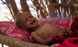 بعد العدوان السعودي 10 ألآف طفل يمني هم ضحية إنهيار النظام الصحي